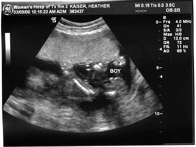 ultrasound picture